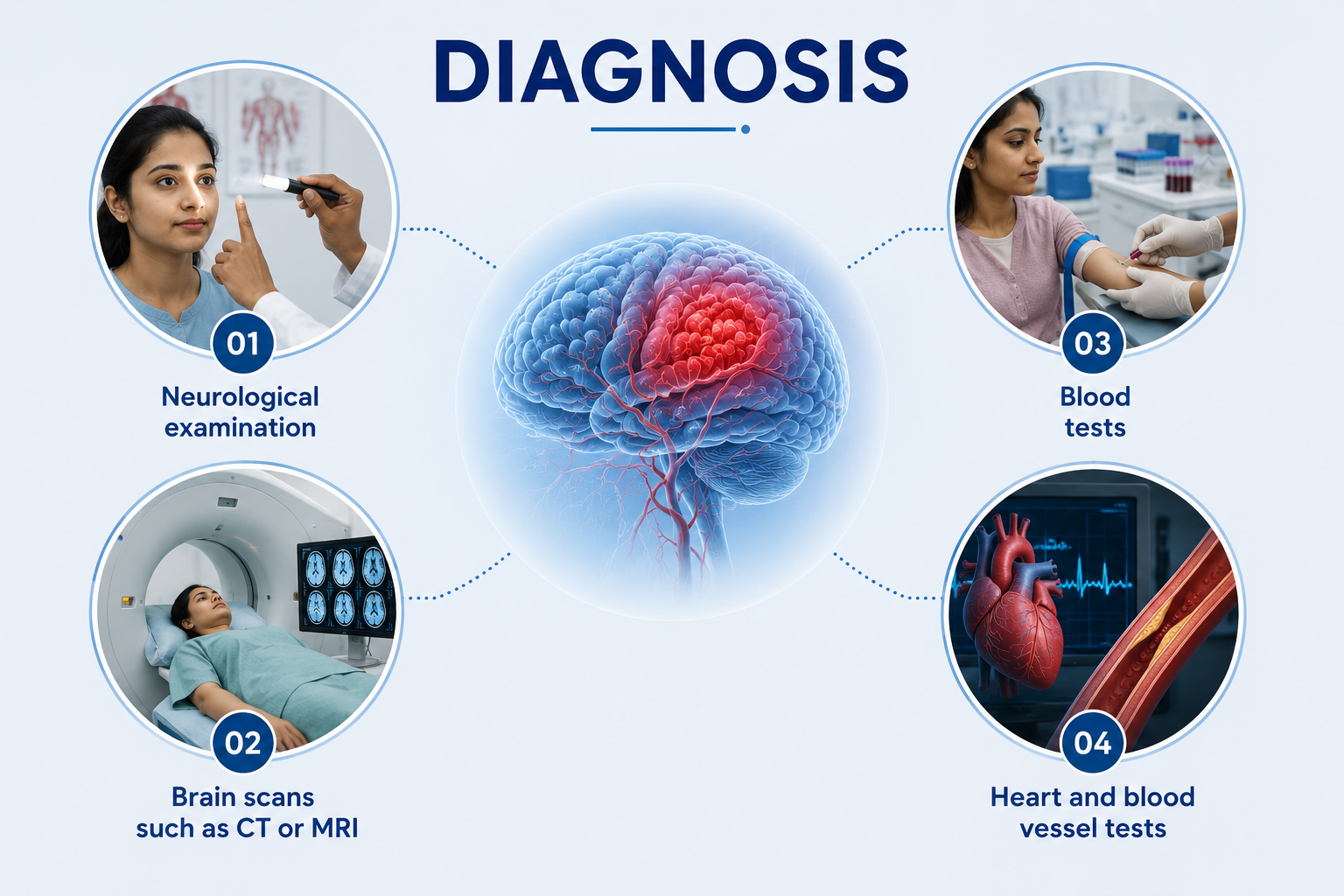 Stroke Diagnosis
